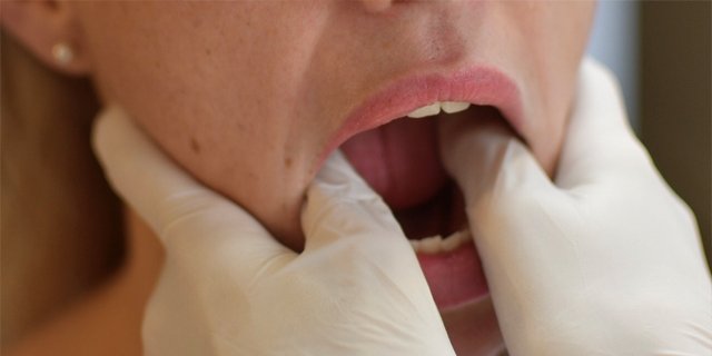 Orthodontie et ostéopathie